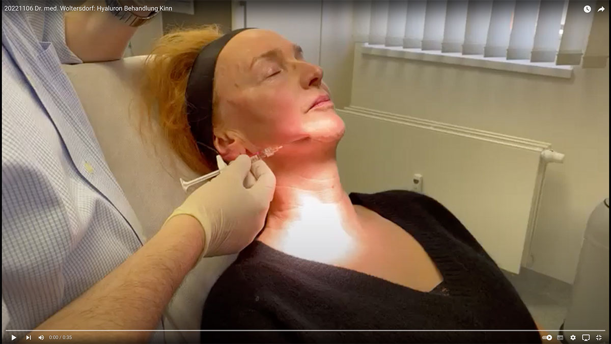 Video: Dr. med. Woltersdorf: Hyaluron-Behandlung der Kinnlinie