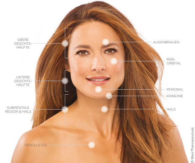 Merz Aesthetics Ultherapy®: Behandlungs-Areale